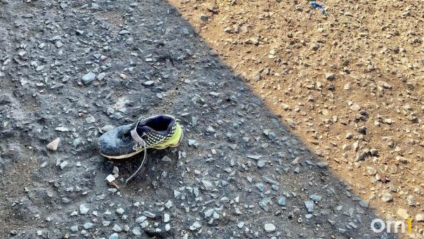 В Омске на улице сломали челюсть молодому парню