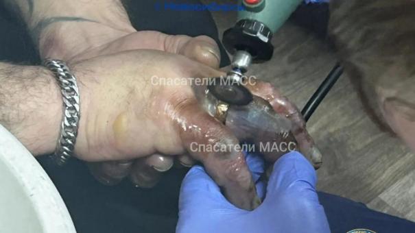 Спасатели сняли кольцо с обмороженного пальца мужчины в Новосибирске
