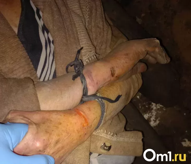 Восемь дней без еды и воды. Омская пенсионерка выжила, просидев в погребе связанной