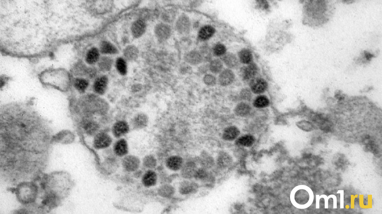 Официально: в Омске зафиксировали первые случаи заражения штаммом «омикрон»